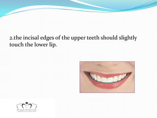 2.the incisal edges of the upper teeth should slightly
touch the lower lip.
 