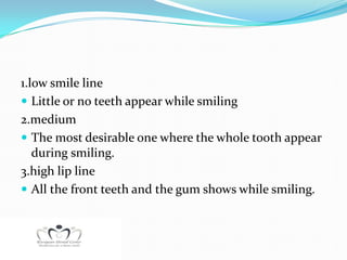 1.low smile line
 Little or no teeth appear while smiling
2.medium
 The most desirable one where the whole tooth appear
   during smiling.
3.high lip line
 All the front teeth and the gum shows while smiling.
 