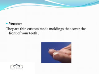  Veneers
They are thin custom made moldings that cover the
 front of your teeth .
 