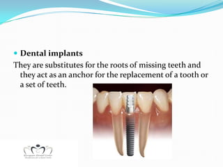 Dental implants
They are substitutes for the roots of missing teeth and
 they act as an anchor for the replacement of a tooth or
 a set of teeth.
 