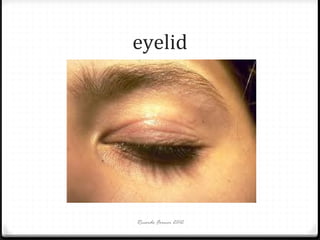 eyelid

Ricardo Forner 2012

 