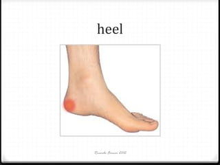 heel

Ricardo Forner 2012

 