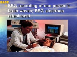 back
  • EEG recording of one person's
   brain waves; EEG electrode
   attachment .
 