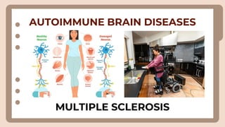 AUTOIMMUNE BRAIN DISEASES
MULTIPLE SCLEROSIS
 
