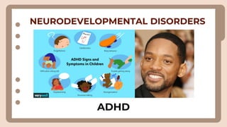 NEURODEVELOPMENTAL DISORDERS
ADHD
 