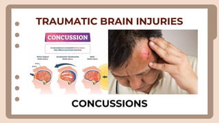 TRAUMATIC BRAIN INJURIES
CONCUSSIONS
 