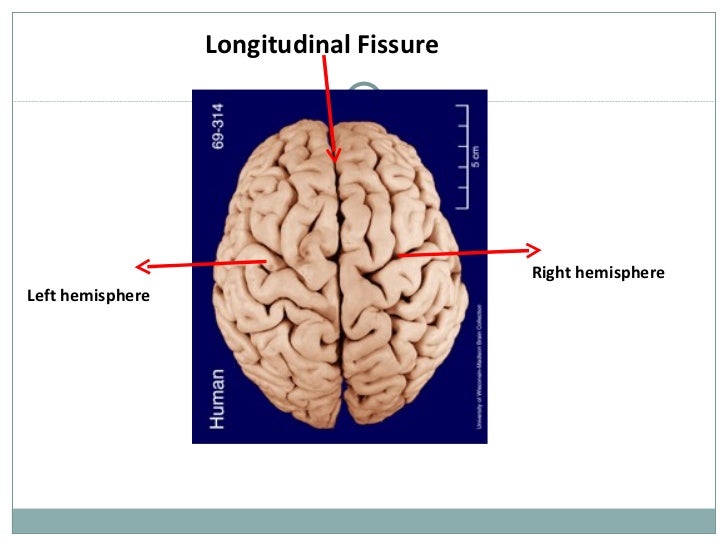 The human brain presentation