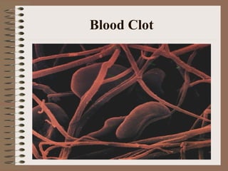 Blood Clot
 