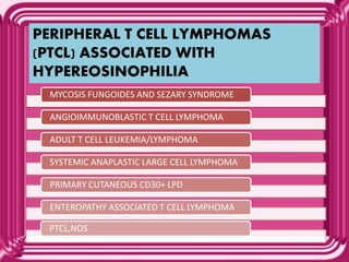 PERIPHERAL T CELL LYMPHOMAS
(PTCL) ASSOCIATED WITH
HYPEREOSINOPHILIA
MYCOSIS FUNGOIDES AND SEZARY SYNDROME
ANGIOIMMUNOBLASTIC T CELL LYMPHOMA
ADULT T CELL LEUKEMIA/LYMPHOMA
SYSTEMIC ANAPLASTIC LARGE CELL LYMPHOMA
PRIMARY CUTANEOUS CD30+ LPD
ENTEROPATHY ASSOCIATED T CELL LYMPHOMA
PTCL,NOS
 
