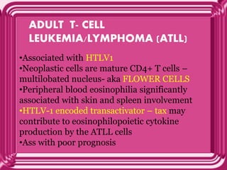 ADULT T- CELL
LEUKEMIA/LYMPHOMA (ATLL)
•Associated with HTLV1
•Neoplastic cells are mature CD4+ T cells –
multilobated nucleus- aka FLOWER CELLS
•Peripheral blood eosinophilia significantly
associated with skin and spleen involvement
•HTLV-1 encoded transactivator – tax may
contribute to eosinophilopoietic cytokine
production by the ATLL cells
•Ass with poor prognosis
 