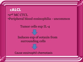 cALCL
•2nd MC CTCL
•Peripheral blood eosinophilia - uncommon
Tumor cells exp IL-4
Induces exp of eotaxin from
surrounding cells
Cause eosinophil chemotaxis
 
