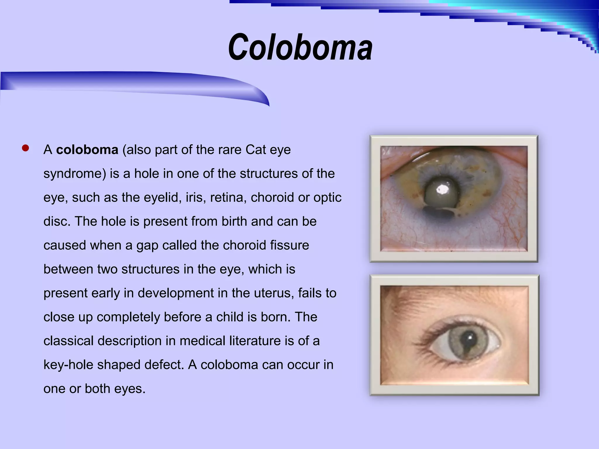 The human eye 10 13-2011 | PPT