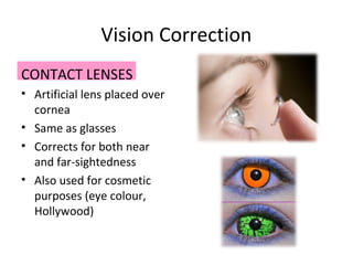 Vision Correction
CONTACT LENSES
• Artificial lens placed over
cornea
• Same as glasses
• Corrects for both near
and far-sightedness
• Also used for cosmetic
purposes (eye colour,
Hollywood)
 