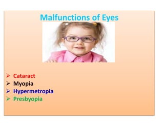 Malfunctions of Eyes
 Cataract
 Myopia
 Hypermetropia
 Presbyopia
 