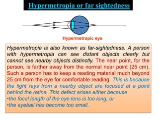 Hypermetropia or far sightedness
Hypermetropic eye
Hypermetropia is also known as far-sightedness. A person
with hypermetropia can see distant objects clearly but
cannot see nearby objects distinctly. The near point, for the
person, is farther away from the normal near point (25 cm).
Such a person has to keep a reading material much beyond
25 cm from the eye for comfortable reading. This is because
the light rays from a nearby object are focused at a point
behind the retina. This defect arises either because
•the focal length of the eye lens is too long, or
•the eyeball has become too small.
 