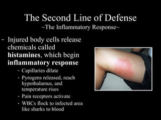 - Injured body cells release
chemicals called
histamines, which begin
inflammatory response
- Capillaries dilate
- Pyrogens released, reach
hypothalamus, and
temperature rises
- Pain receptors activate
- WBCs flock to infected area
like sharks to blood
The Second Line of Defense
~The Inflammatory Response~
 