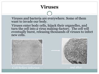 Viruses
Viruses and bacteria are everywhere. Some of them
want to invade our body.
Viruses enter body cells, hijack their organelles, and
turn the cell into a virus making-factory. The cell will
eventually burst, releasing thousands of viruses to infect
new cells.
Cell before infection… …and after.
 