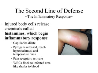 - Injured body cells release
chemicals called
histamines, which begin
inflammatory response
- Capillaries dilate
- Pyrogens released, reach
hypothalamus, and
temperature rises
- Pain receptors activate
- WBCs flock to infected area
like sharks to blood
The Second Line of Defense
~The Inflammatory Response~
 