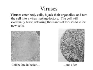 Viruses
Viruses enter body cells, hijack their organelles, and turn
the cell into a virus making-factory. The cell will
eventually burst, releasing thousands of viruses to infect
new cells.
Cell before infection… …and after.
 