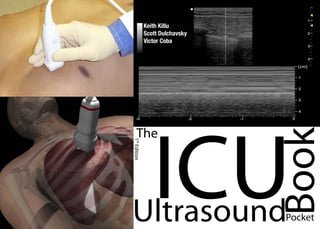 The
ICU
Ultrasound
Book
Pocket
1
st
Edition
Keith Killu
Scott Dulchavsky
Victor Coba
 
