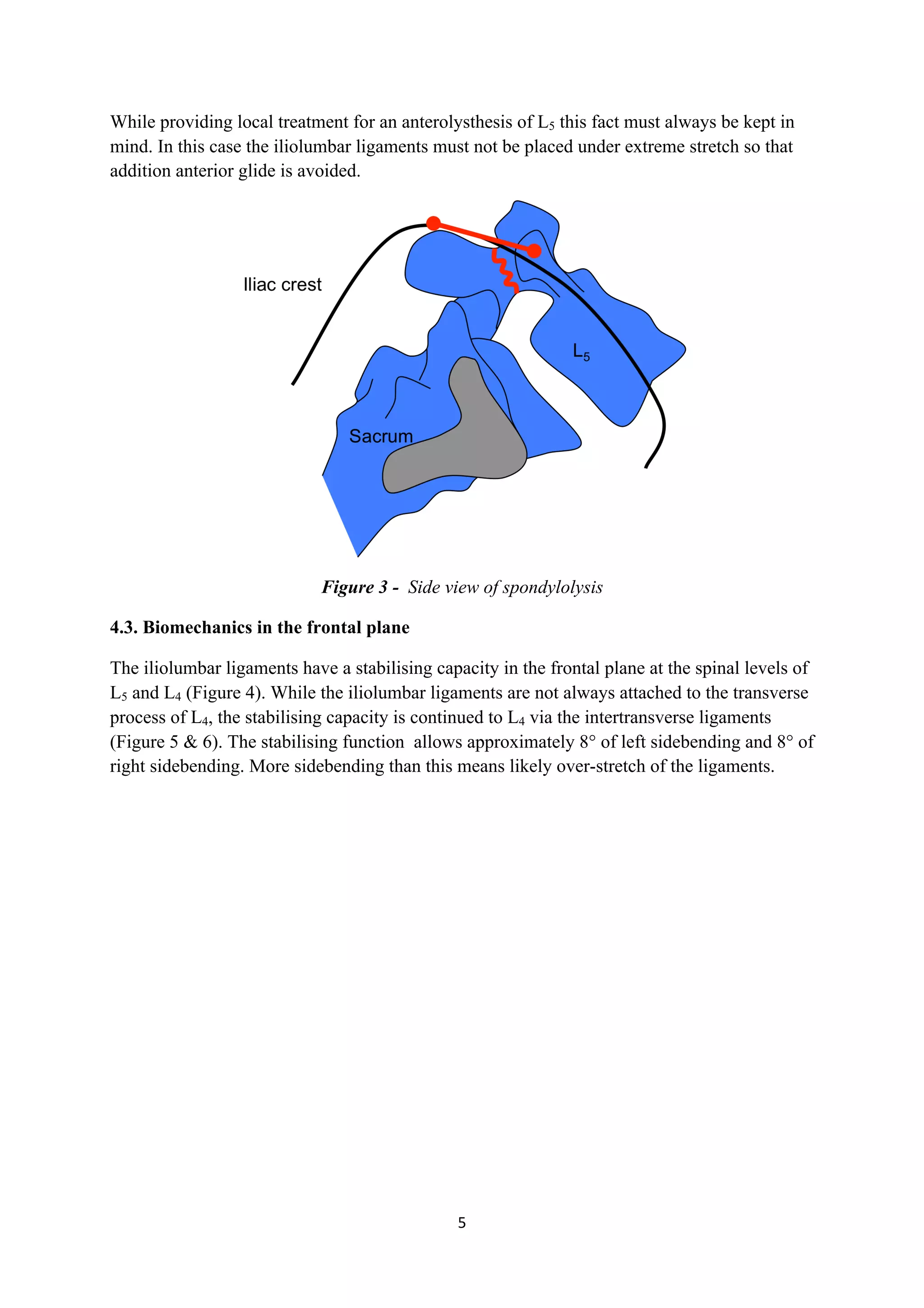 While providing local treatment for an anterolysthesis of L5 this fact must always be kept in
mind. In this case the iliolumbar ligaments must not be placed under extreme stretch so that
addition anterior glide is avoided.




                             Figure 3 - Side view of spondylolysis

4.3. Biomechanics in the frontal plane

The iliolumbar ligaments have a stabilising capacity in the frontal plane at the spinal levels of
L5 and L4 (Figure 4). While the iliolumbar ligaments are not always attached to the transverse
process of L4, the stabilising capacity is continued to L4 via the intertransverse ligaments
(Figure 5 & 6). The stabilising function allows approximately 8° of left sidebending and 8° of
right sidebending. More sidebending than this means likely over-stretch of the ligaments.




                                               5	
  
	
  
 