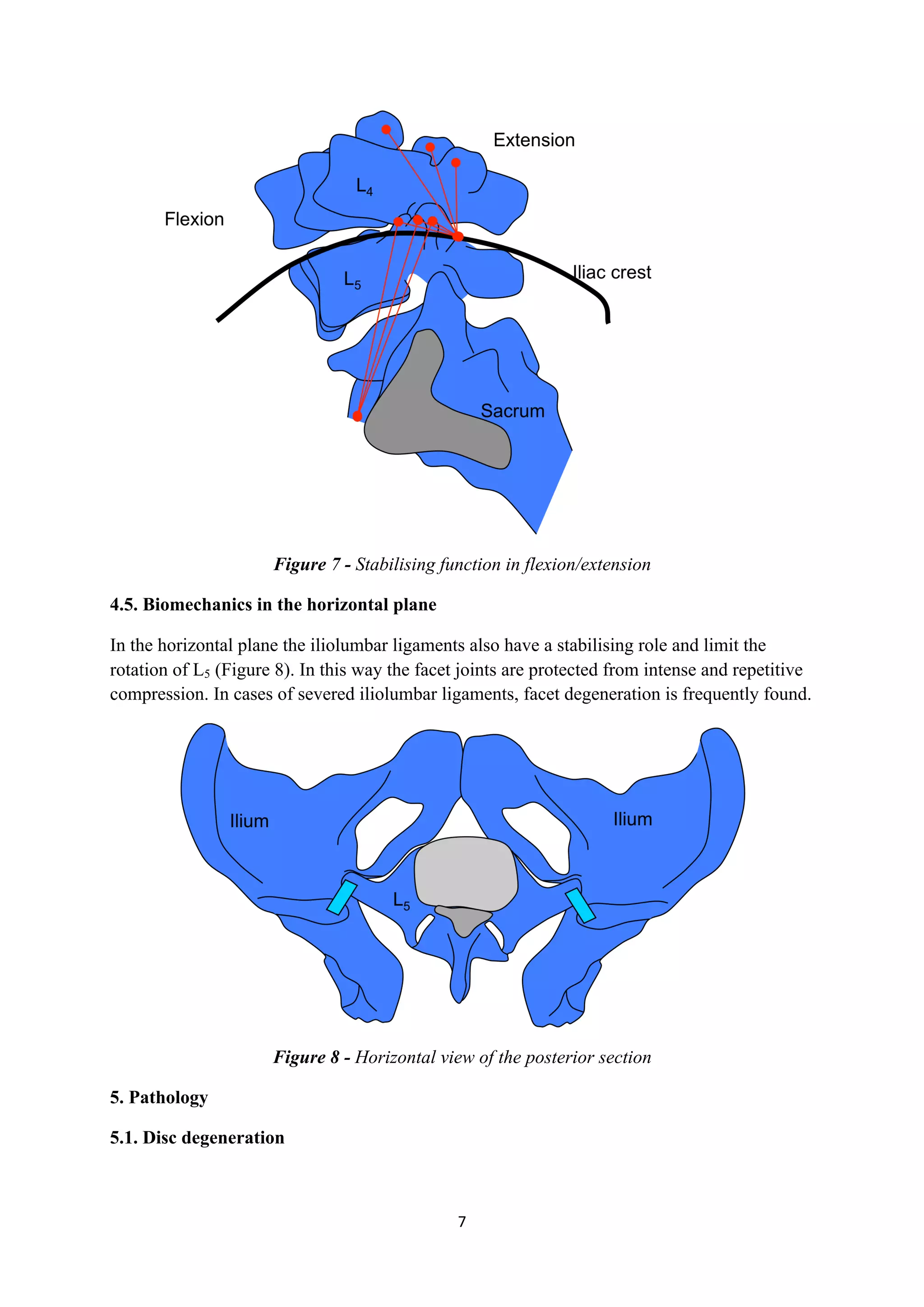 Figure 7 - Stabilising function in flexion/extension

4.5. Biomechanics in the horizontal plane

In the horizontal plane the iliolumbar ligaments also have a stabilising role and limit the
rotation of L5 (Figure 8). In this way the facet joints are protected from intense and repetitive
compression. In cases of severed iliolumbar ligaments, facet degeneration is frequently found.




                      Figure 8 - Horizontal view of the posterior section

5. Pathology

5.1. Disc degeneration



                                                7	
  
	
  
 