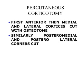 PERCUTANEOUS
CORTICOTOMY
• FIRST ANTERIOR THEN MEDIAL
AND LATERAL CORTICES CUT
WITH OSTEOTOME
• SIMILARLY POSTEROMEDIAL
AND POSTERO LATERAL
CORNERS CUT
 