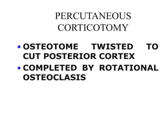 PERCUTANEOUS
CORTICOTOMY
• OSTEOTOME TWISTED TO
CUT POSTERIOR CORTEX
• COMPLETED BY ROTATIONAL
OSTEOCLASIS
 
