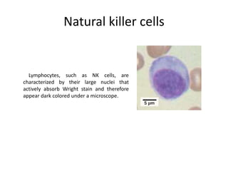 Natural killer cells
Lymphocytes, such as NK cells, are
characterized by their large nuclei that
actively absorb Wright stain and therefore
appear dark colored under a microscope.
 