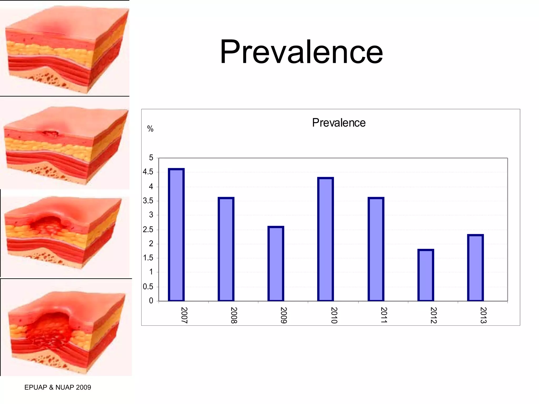 Prevalence 
EPUAP & NUAP 2009 
Prevalence 
5 
4.5 
4 
3.5 
3 
2.5 
2 
1.5 
1 
0.5 
0 
2007 
2008 
2009 
2010 
2011 
2012 
2013 
% 
 