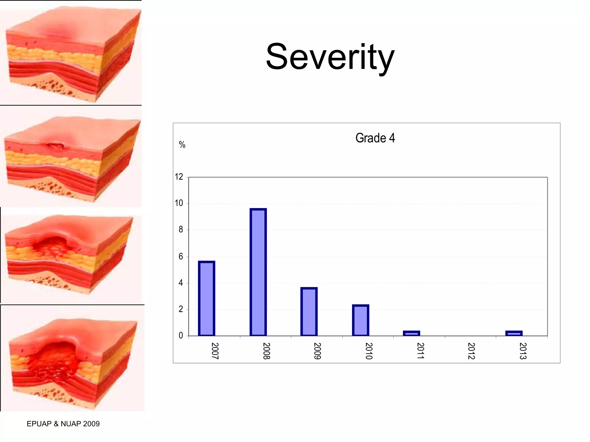 Severity 
EPUAP & NUAP 2009 
Grade 4 
12 
10 
8 
6 
4 
2 
0 
2007 
2008 
2009 
2010 
2011 
2012 
2013 
% 
 