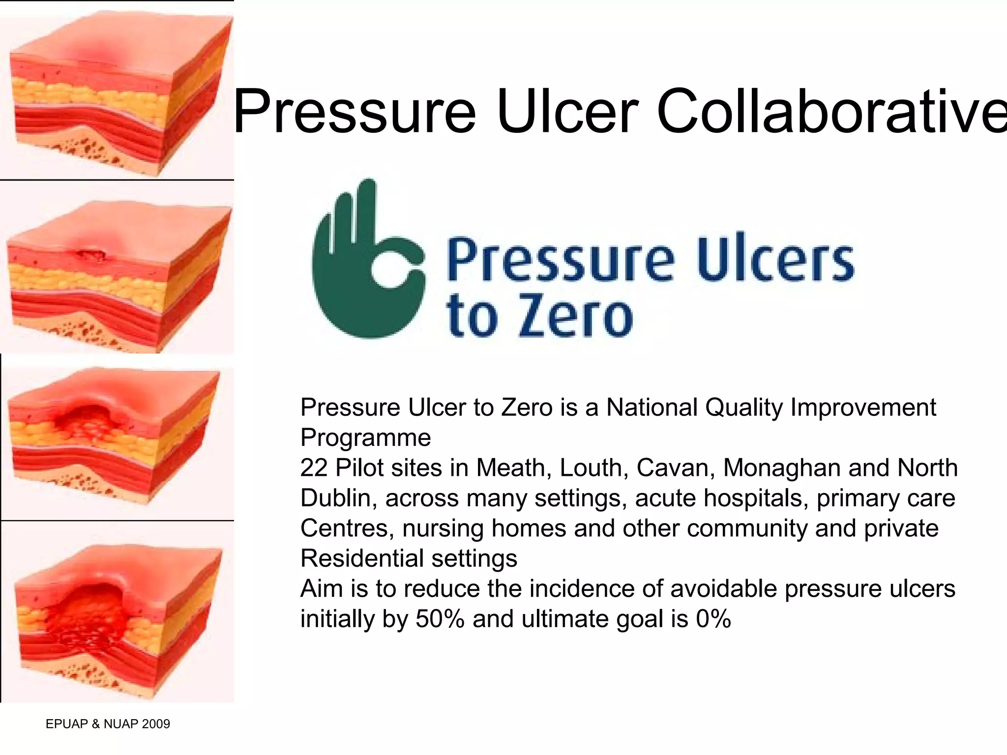 Pressure Ulcer Collaborative 
EPUAP & NUAP 2009 
Pressure Ulcer to Zero is a National Quality Improvement 
Programme 
22 Pilot sites in Meath, Louth, Cavan, Monaghan and North 
Dublin, across many settings, acute hospitals, primary care 
Centres, nursing homes and other community and private 
Residential settings 
Aim is to reduce the incidence of avoidable pressure ulcers 
initially by 50% and ultimate goal is 0% 
 