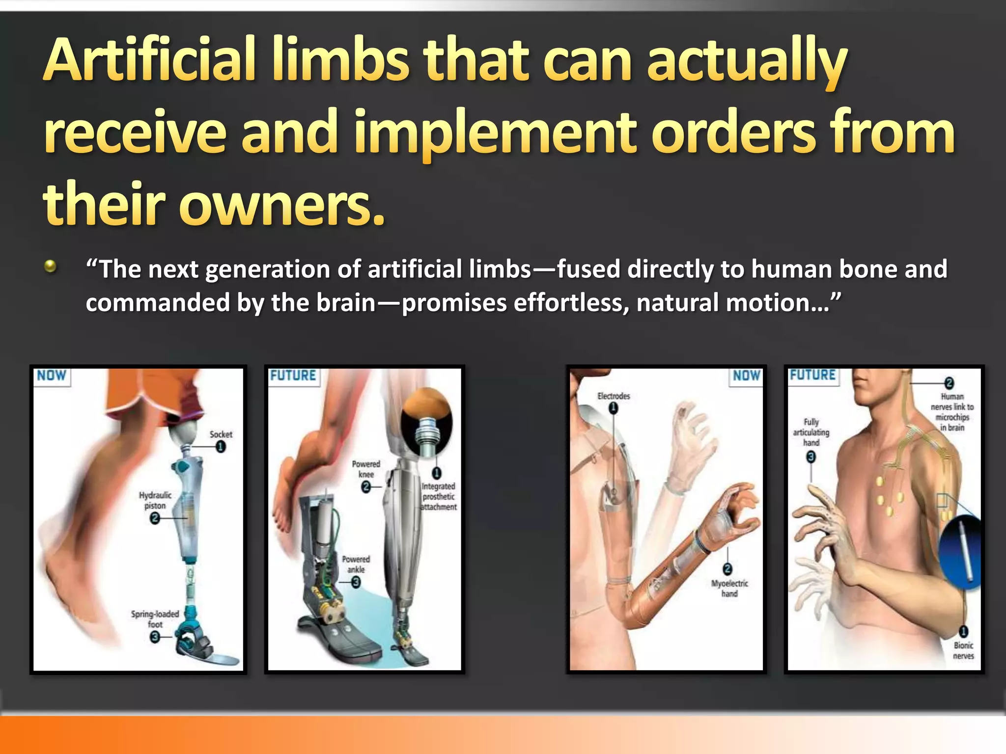 Insulin Pump Breakthrough: The NanopumpDebiotech is a Swiss company that has come out with an Insulin Nanopump that is placed outside the body but is designed in such a way that it delivers the required amount of insulin to a diabetic on a regular basis.