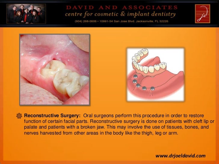 Importance of a Good Oral Surgeon