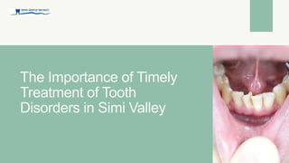 The Importance of Timely
Treatment of Tooth
Disorders in Simi Valley
 
