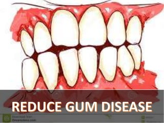 The important reasons of brushing your teeth | PPTX