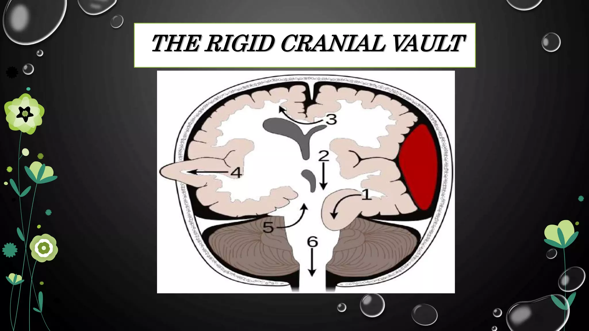 Nursing management client with Increased intracranial pressure ( ICP) | PPTX