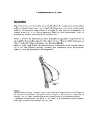 Inframamry Incision The Inframammary Crease | PDF