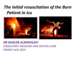 DR GHALEB ALMEKHLAFI
CONSULTANT MEDICINE AND CRITICAL CARE
PSMMC AUG 2014
 