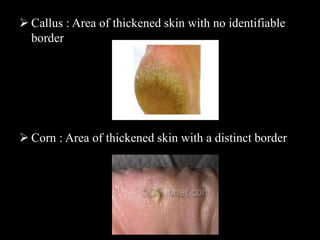 The integumentary system | PDF