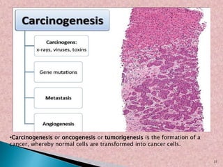 •Carcinogenesis or oncogenesis or tumorigenesis is the formation of a
cancer, whereby normal cells are transformed into cancer cells.
31
 