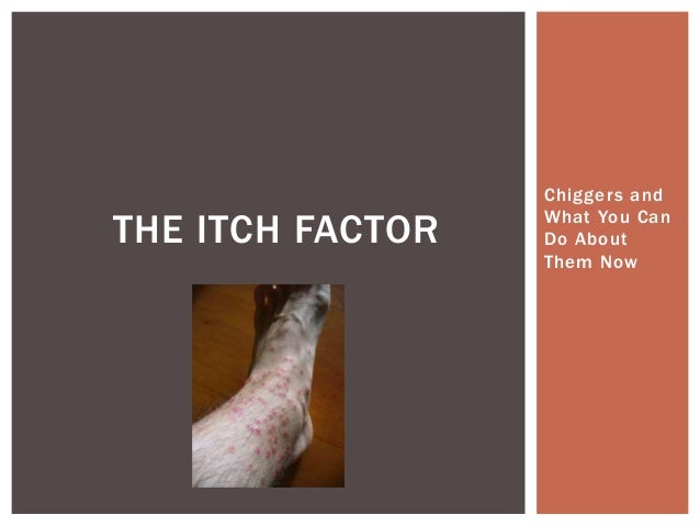 Chiggers and
What You Can
Do About
Them Now
THE ITCH FACTOR
 