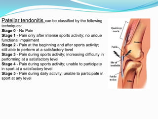 The knee and related structures f09 | PPTX