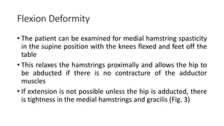 Flexion Deformity
• The patient can be examined for medial hamstring spasticity
in the supine position with the knees flexed and feet off the
table
• This relaxes the hamstrings proximally and allows the hip to
be abducted if there is no contracture of the adductor
muscles
• If extension is not possible unless the hip is adducted, there
is tightness in the medial hamstrings and gracilis (Fig. 3)
 