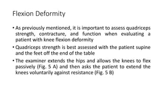 Flexion Deformity
• As previously mentioned, it is important to assess quadriceps
strength, contracture, and function when evaluating a
patient with knee flexion deformity
• Quadriceps strength is best assessed with the patient supine
and the feet off the end of the table
• The examiner extends the hips and allows the knees to flex
passively (Fig. 5 A) and then asks the patient to extend the
knees voluntarily against resistance (Fig. 5 B)
 