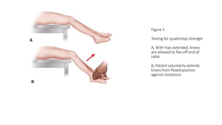 Figure 5
Testing for quadriceps strength
A, With hips extended, knees
are allowed to flex off end of
table
B, Patient voluntarily extends
knees from flexed position
against resistance.
 