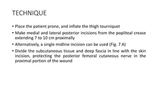TECHNIQUE
• Place the patient prone, and inflate the thigh tourniquet
• Make medial and lateral posterior incisions from the popliteal crease
extending 7 to 10 cm proximally
• Alternatively, a single midline incision can be used (Fig. 7 A)
• Divide the subcutaneous tissue and deep fascia in line with the skin
incision, protecting the posterior femoral cutaneous nerve in the
proximal portion of the wound
 
