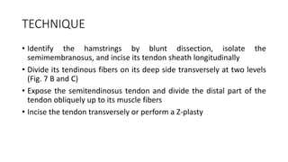 TECHNIQUE
• Identify the hamstrings by blunt dissection, isolate the
semimembranosus, and incise its tendon sheath longitudinally
• Divide its tendinous fibers on its deep side transversely at two levels
(Fig. 7 B and C)
• Expose the semitendinosus tendon and divide the distal part of the
tendon obliquely up to its muscle fibers
• Incise the tendon transversely or perform a Z-plasty
 