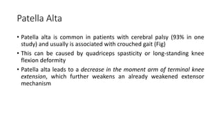 Patella Alta
• Patella alta is common in patients with cerebral palsy (93% in one
study) and usually is associated with crouched gait (Fig)
• This can be caused by quadriceps spasticity or long-standing knee
flexion deformity
• Patella alta leads to a decrease in the moment arm of terminal knee
extension, which further weakens an already weakened extensor
mechanism
 