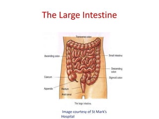 The Large Intestine
Image courtesy of St Mark’s
Hospital
 